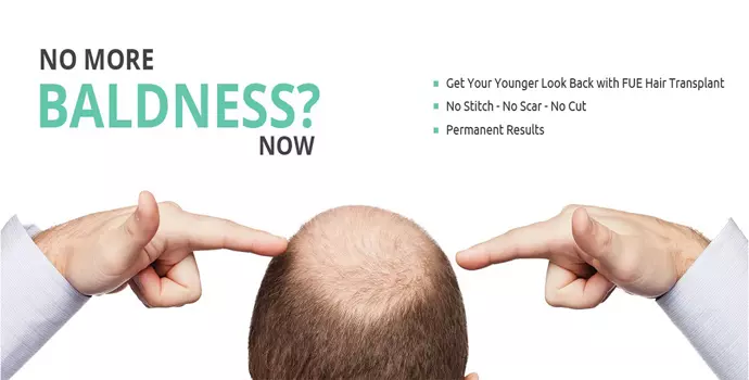 Hair Transplant in Noida