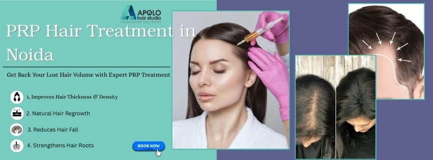 PRP Hair Treatment in noida