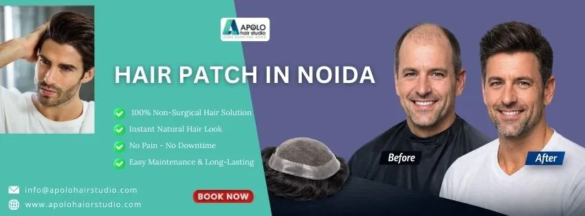 fue hair transplant near me