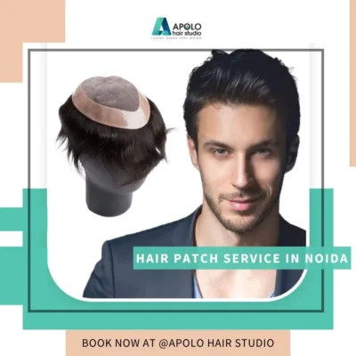 hair patch in noida