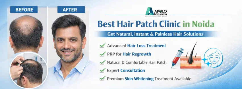 Best Hair Patch Clinic in Noida.