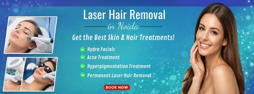laser hair removal in Noida