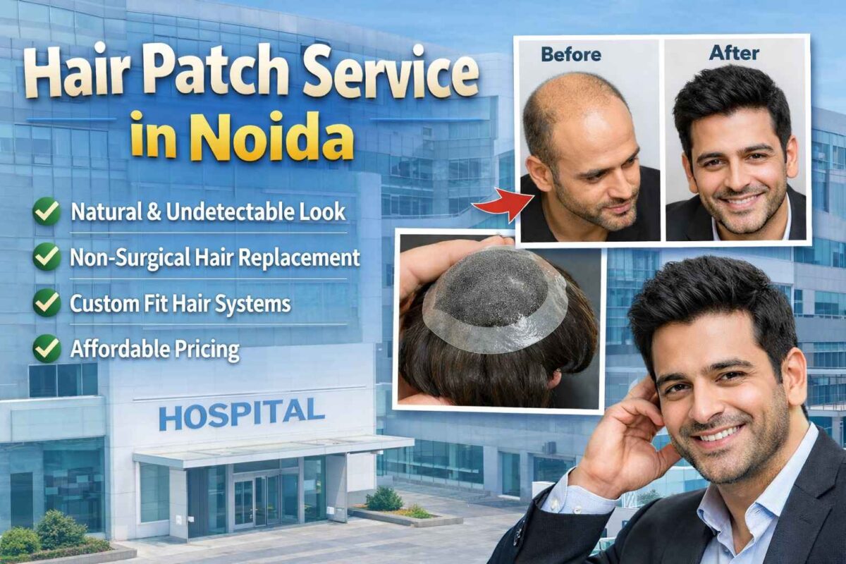 Hair Patch Services in Noida