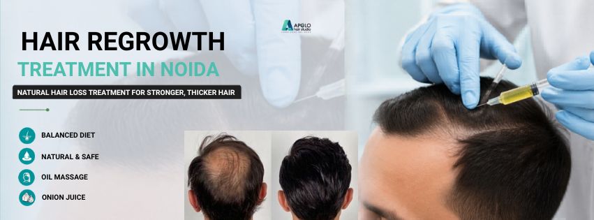 Hair Regrowth Treatment in Noida