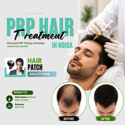 best hair loss treatment