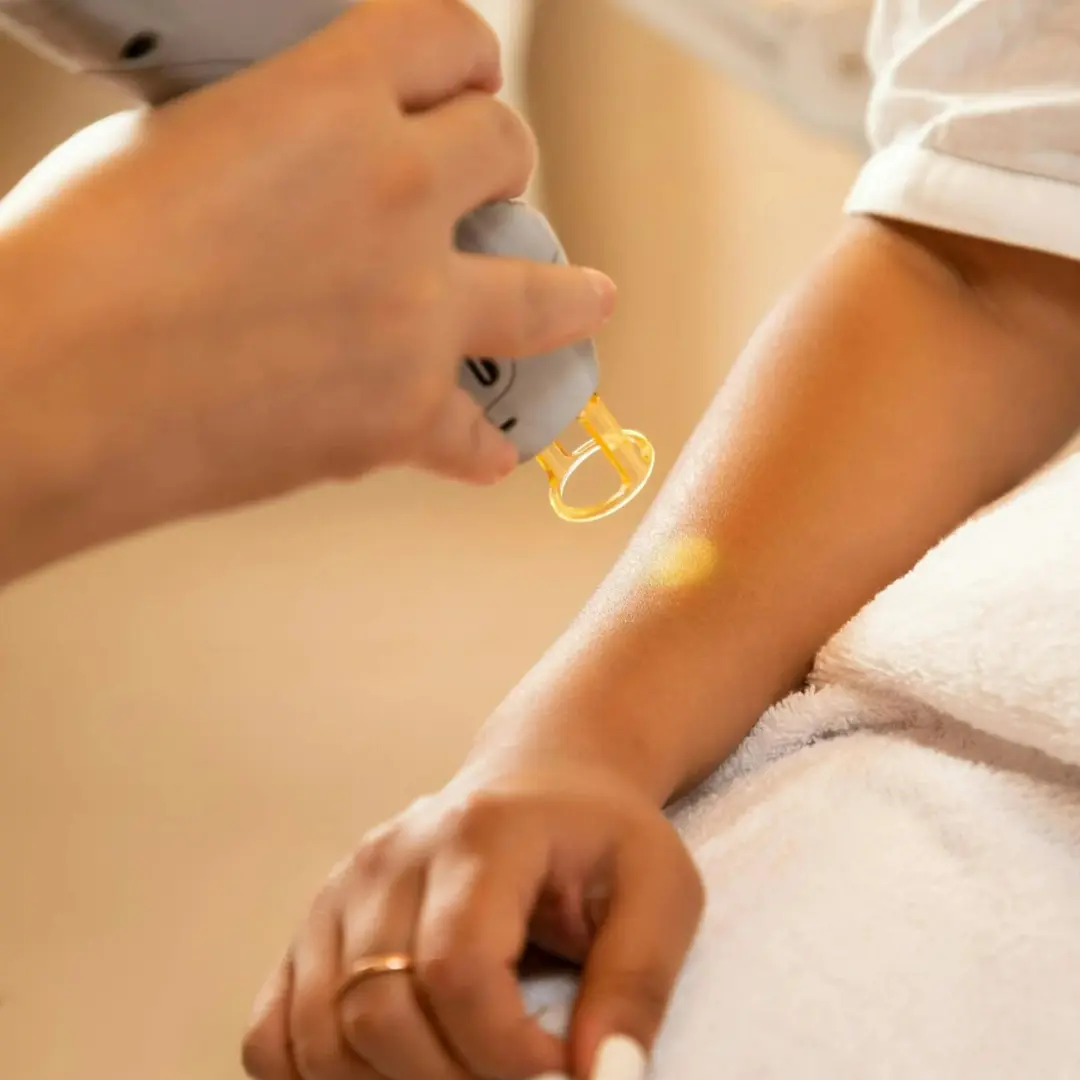laser hair removal in noida