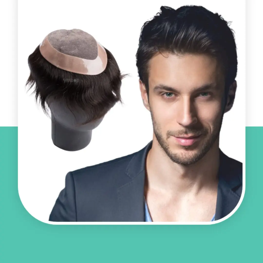 hair patch in noida